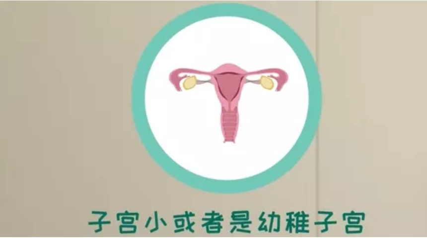 幼稚子宫、子宫偏小、子宫萎缩都可以做供卵吗? 幼稚子宫、子宫偏小、子宫萎缩都可以做供卵吗?