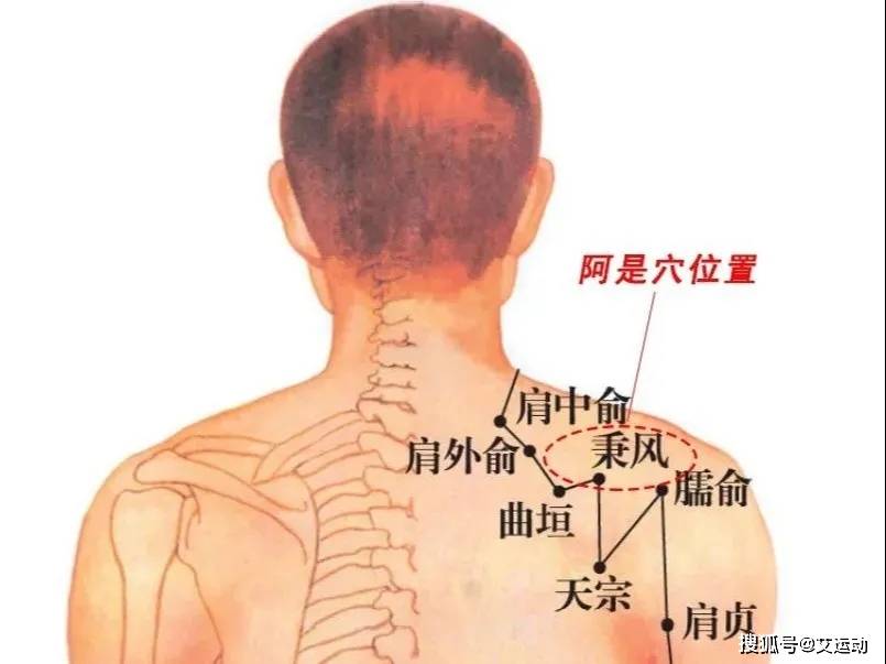 颈肩痛?肩周炎?艾灸疗法轻松缓解!(图6)