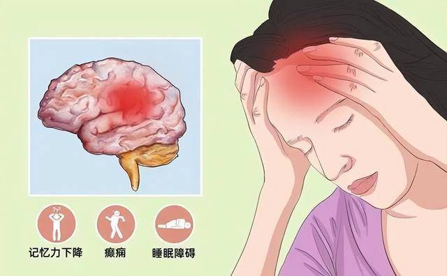《关于脑炎的那些事儿》