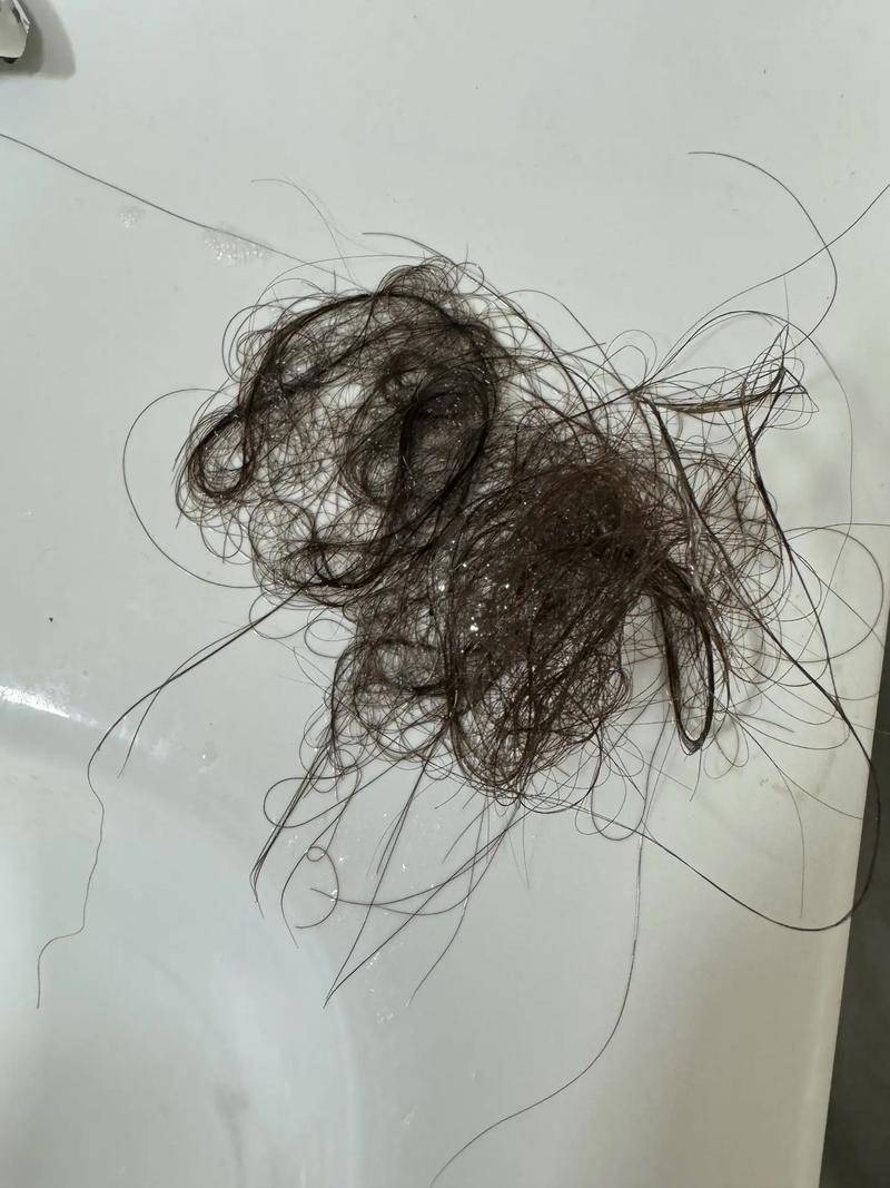 37岁女人掉头发很厉害是什么原因?不能忽略这个