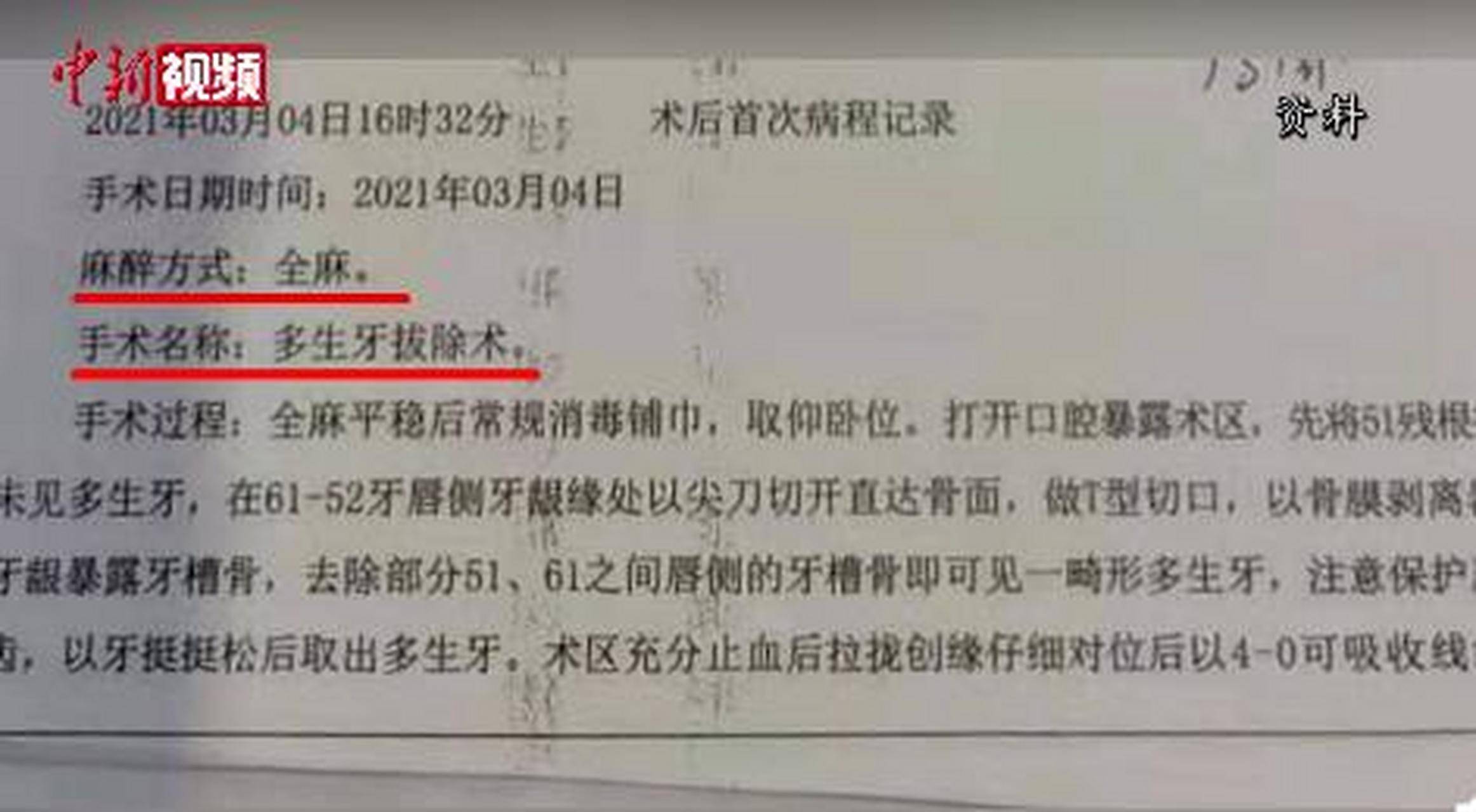 女子拔错牙后离奇坠亡，协商结果曝光，真相令人不寒而栗！