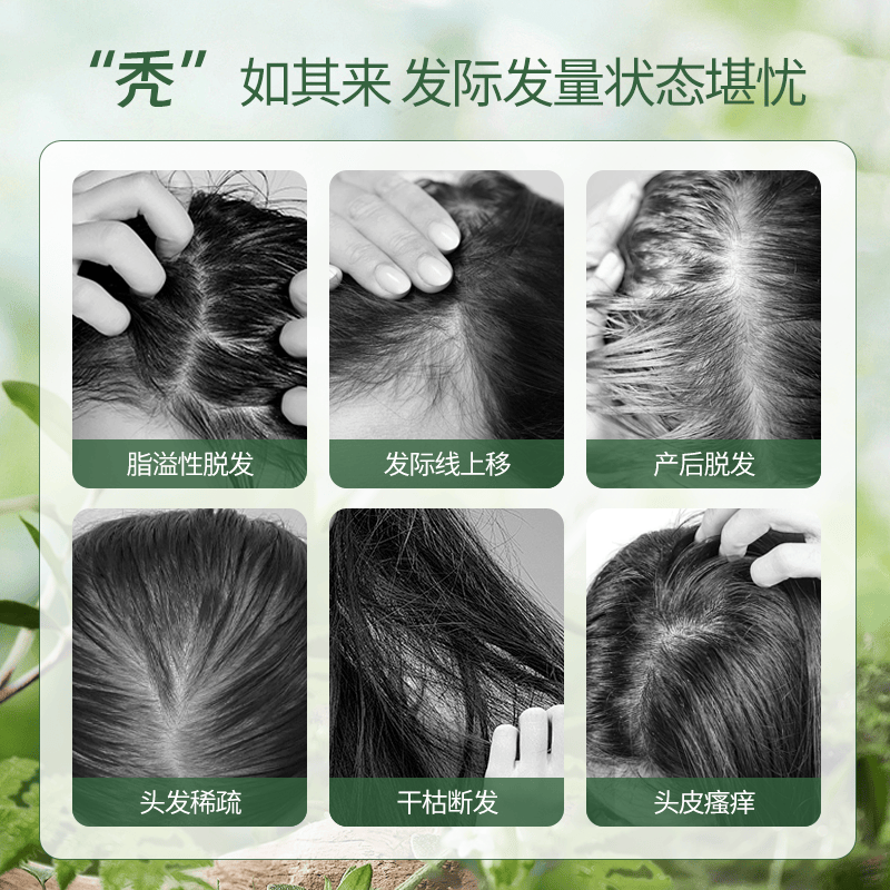 防脱洗发水有用吗！洗发水防脱生发第一名