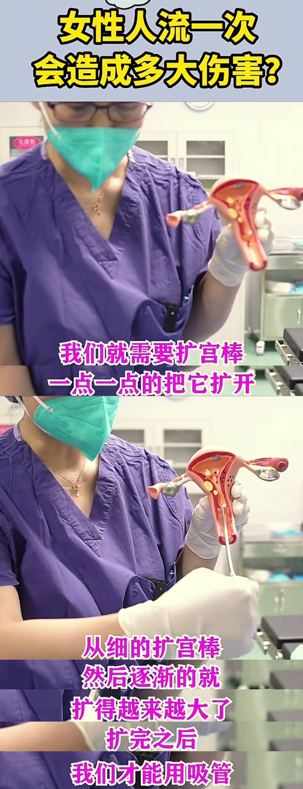 医生用流产器械给子宫模型进行流产,告诉女人:人流有多伤身