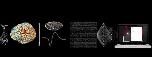 马斯克脑机接口公司重大突破，1.5秒快速植入电极，万人等待上脑