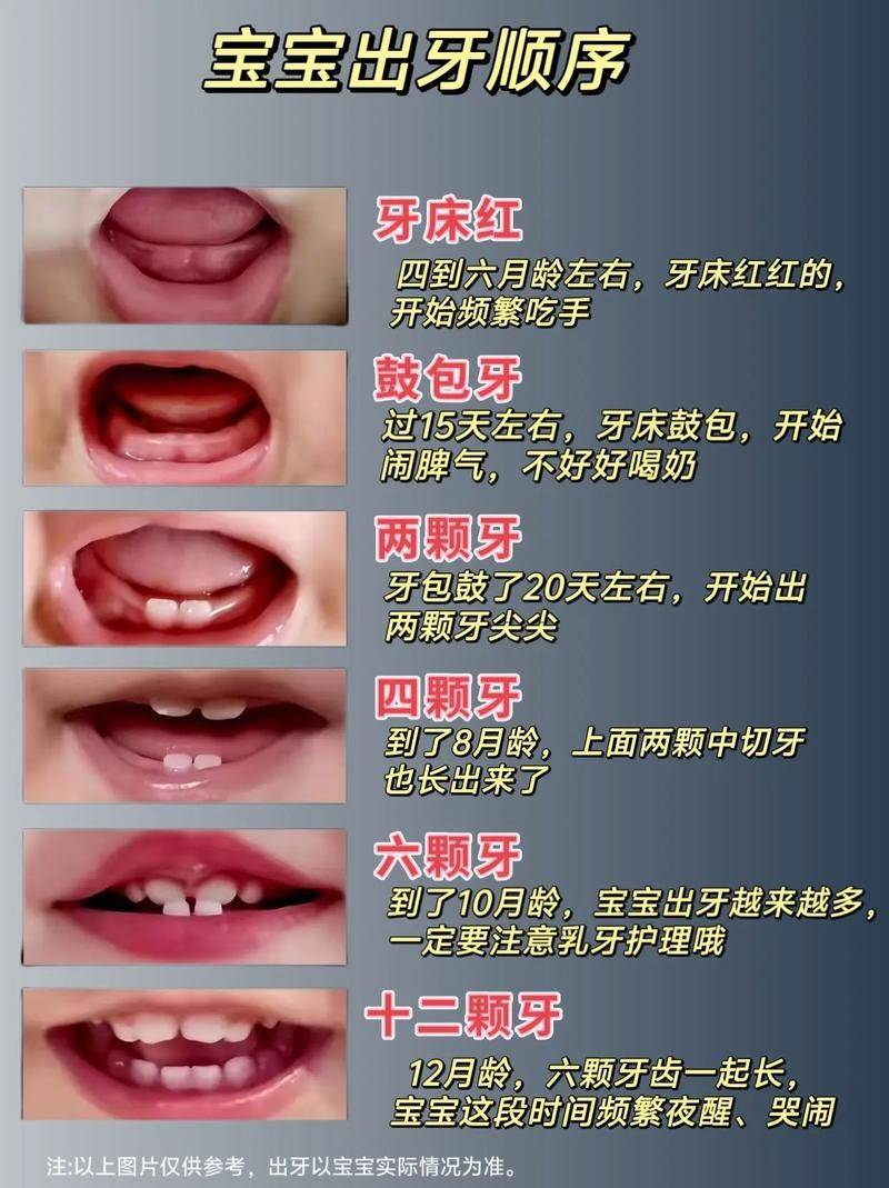 宝宝几个月开始长牙齿才是正常?几个信号要记牢,帮娃缓解不适