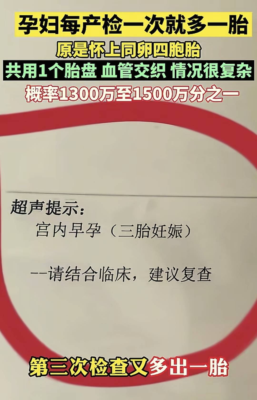 孕妇每产检一次就多一胎,原是怀上同卵四胞胎,医生摇头:要不了