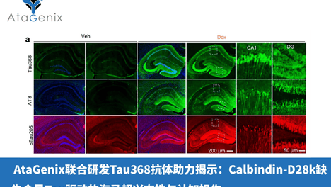 AtaGenix联合研发Tau368抗体助力揭示：Calbindin-D28k缺失介导Tau驱动的海马超兴奋性与认知损伤