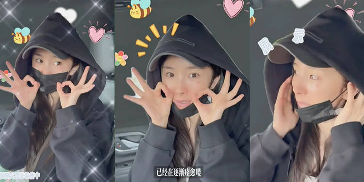 杨幂烫伤后素颜出镜称正在痊愈，气色依旧在线