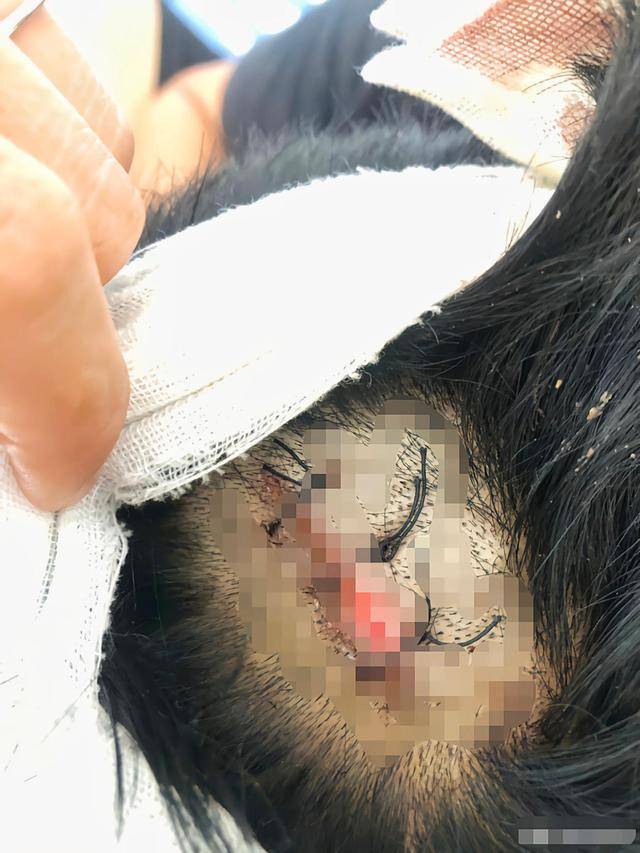 梦境解析，我梦见把一个男孩的头打流血了，意味着什么？