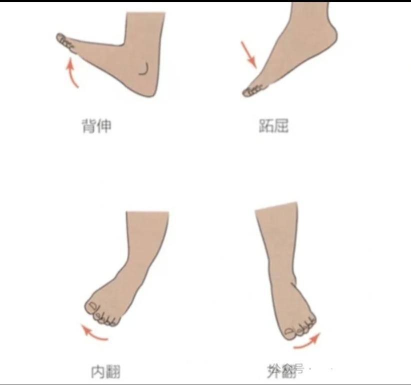 【医文医话】康复中心：跟腱断裂的康复治疗