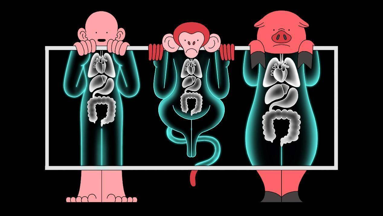 两年前，一位57岁男子移植猪心脏，手术很成功，如今他怎么样了？
