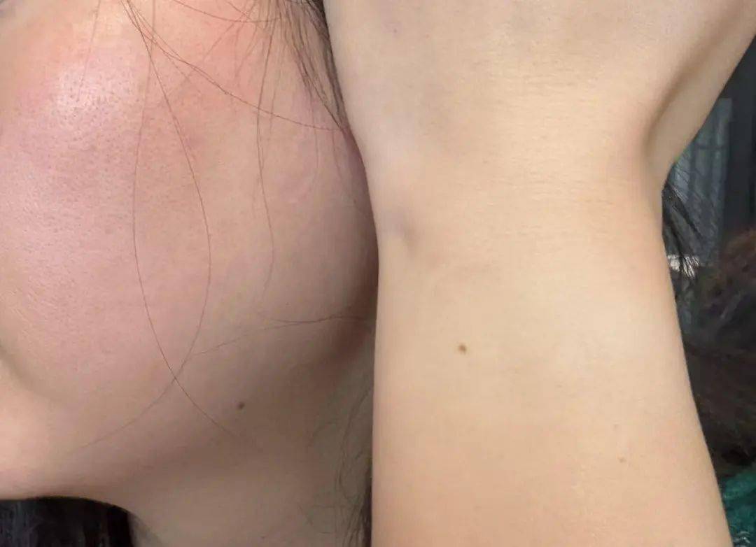 防晒面罩越戴越黑！是热黑的还是捂黑的？