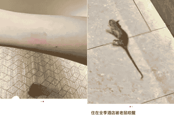 女子入住全季酒店半夜被老鼠咬醒 酒店回应：愿