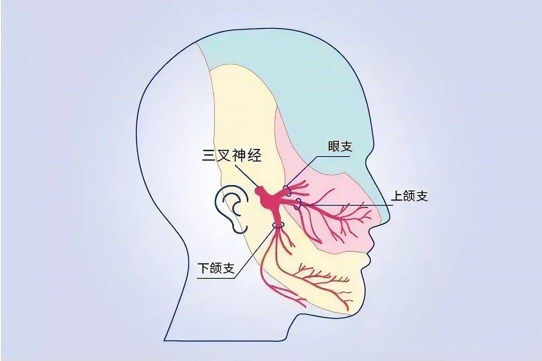 三叉神经痛部位图图片