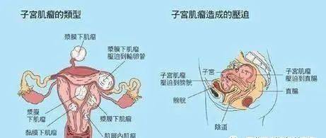 女性下部长什么样的图片