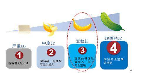 重度阳痿的症状杏欲消失,无论次激性敏感区,接受异性杏次激,还是打