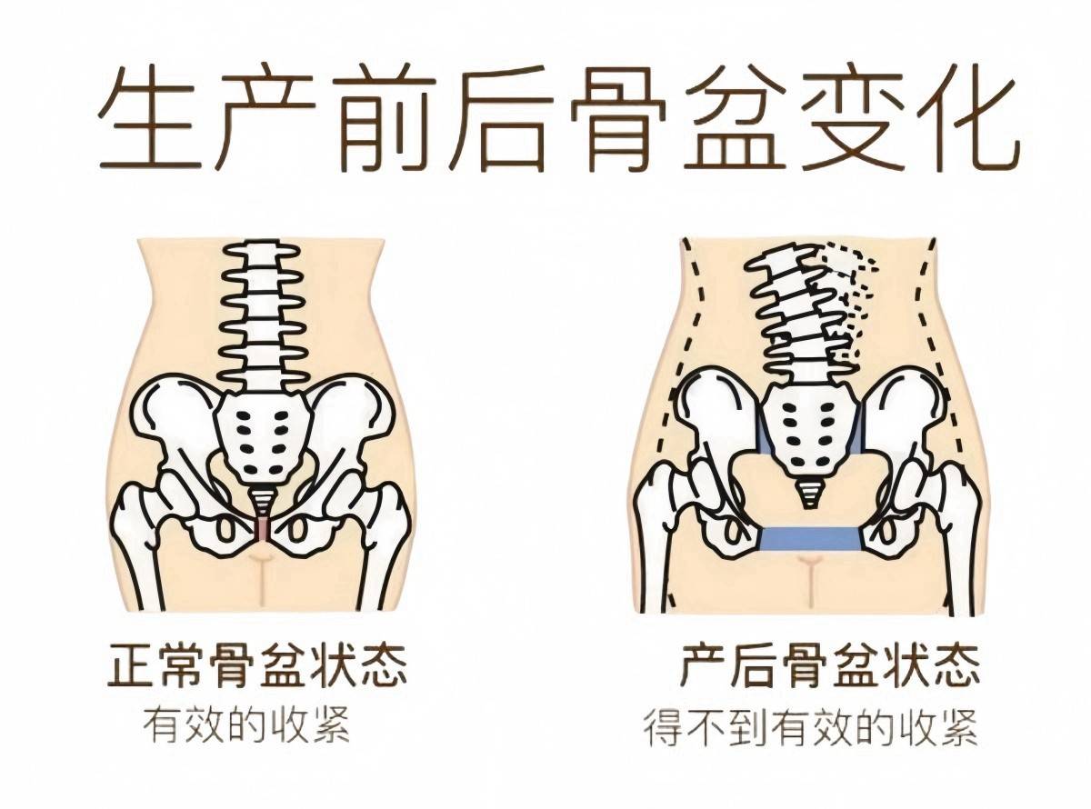 “妇女胯”和“少女胯”有啥区别？怎样才能重回少女胯？