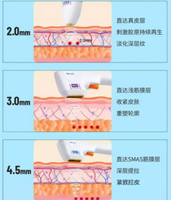 不同,可能會出現短期大小臉現象,請保持良好生活習慣,不單側咀嚼,不