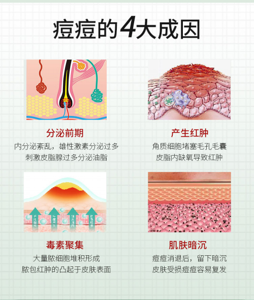 脸部痘痘图解示意图图片