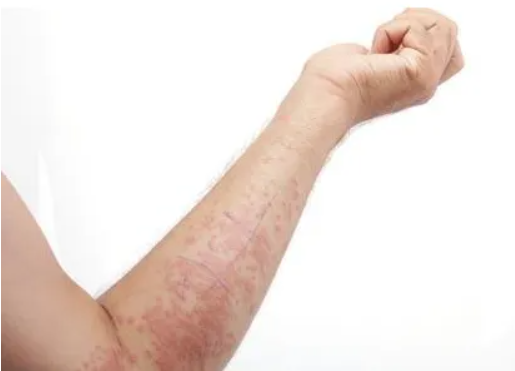 问止小课堂:广东人憎恶的"湿热",怎样才能彻底祛除?_体质_刘先生_问题