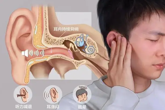 性价比高的开放式耳机怎么选,五款开放式蓝牙耳机推荐