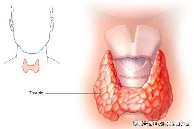 小心!这也许是甲状腺疾病的前兆!_症状_检查_部位