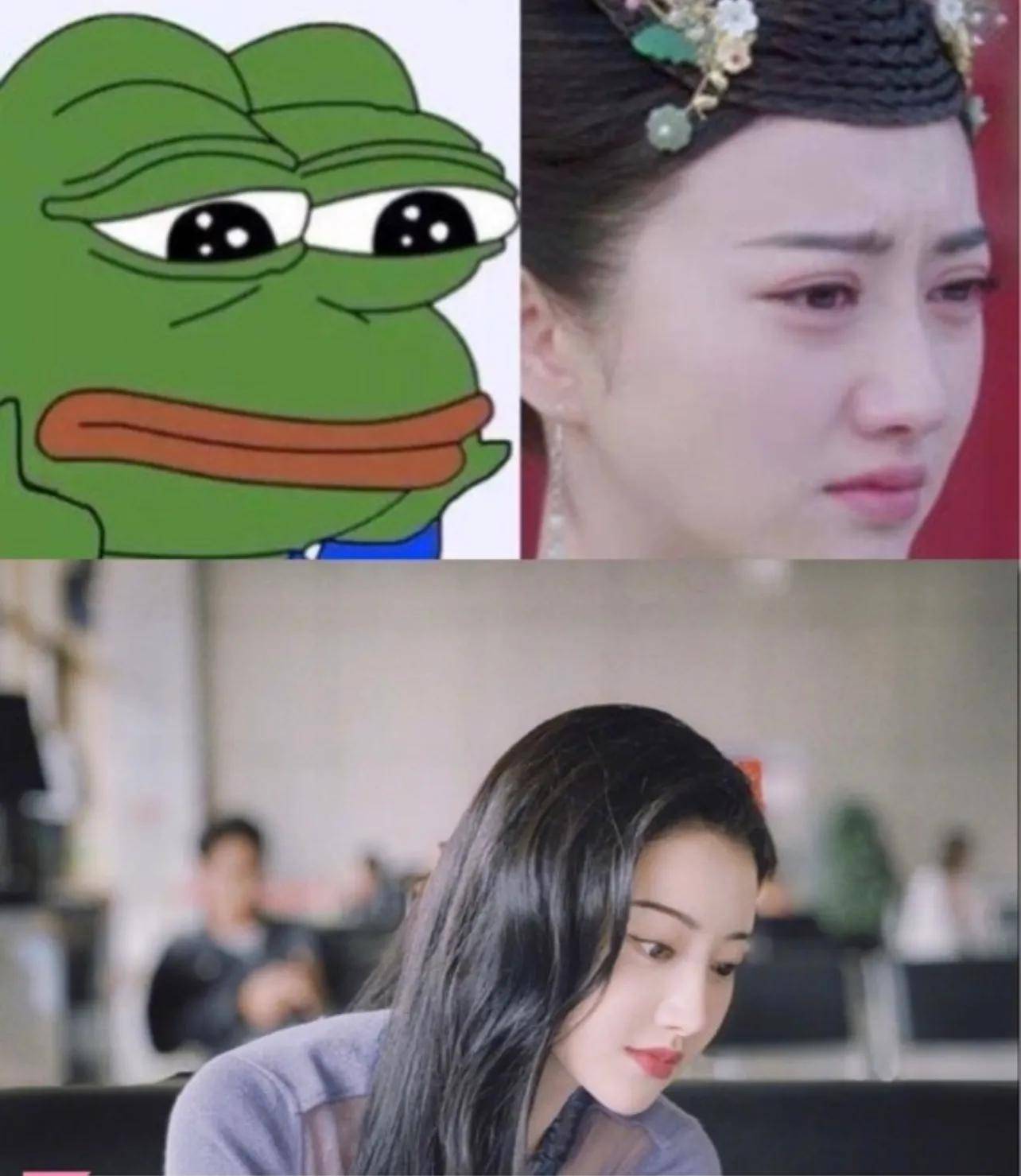 当初景甜也经历过一段时间青蛙眼,比较直观的感受就是双眼皮距离很宽