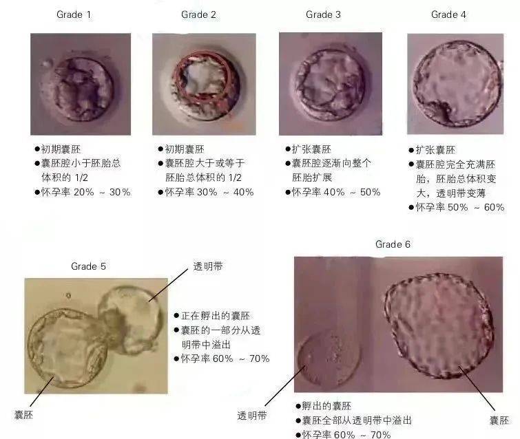 移植第八天胚胎发育图图片