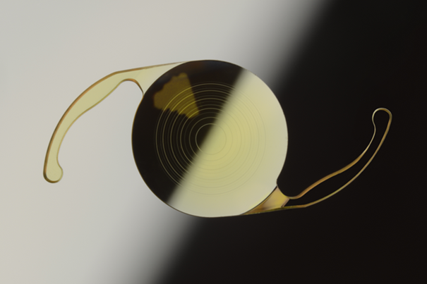 能解决近视,老花问题的老花白内障手术:高端人工晶体带来清晰视觉享受