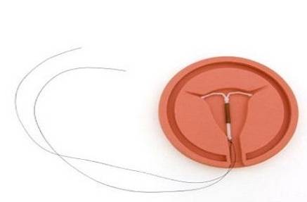 生完二胎后,上环是最好的避孕方式吗?