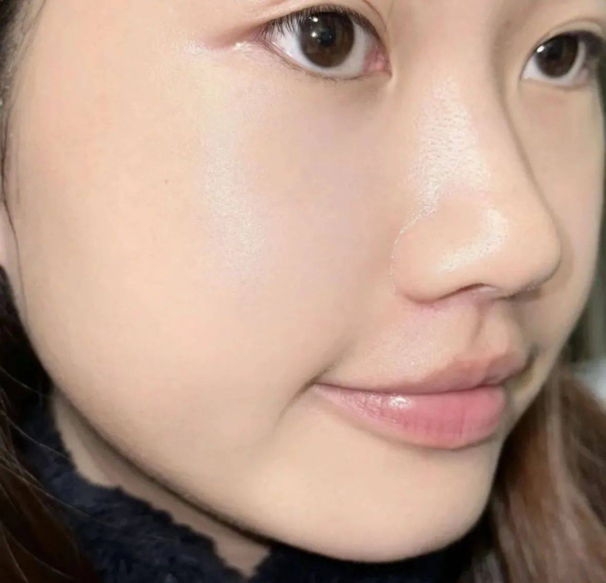 过来人曝光去红秘籍,在家操作更省钱!