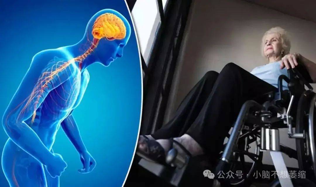 中药宝藏——黑顺片,对小脑萎缩治疗有所帮助,80%患者却给忽略了_医生