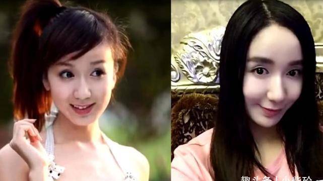 女星整容前后对比,有人美貌出众,有人惨不忍睹_柳岩