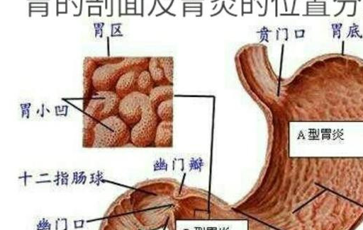 阑尾炎是什么呢?会怎样表现?_腹部_症状_疾病