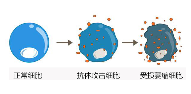 长期恶化或诱发癌症!_甲状腺_抗体_炎症