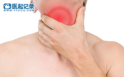 科研人员应该知道的缓解慢性咽炎的四个方法_咽喉_部位_食物