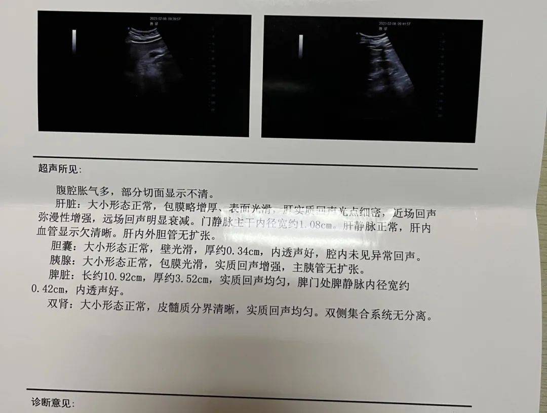 肝脏彩超报告,哪种回声比较危险呢?