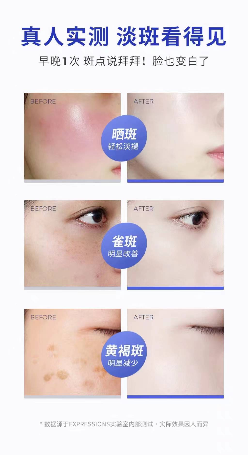 淡斑紧致抗皱的护肤品,这款很爱哦!_肌肤_祛斑_效果