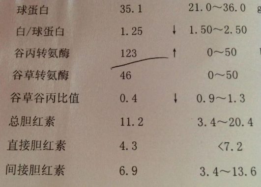 转氨酶高的人,这3件事一定不要做,切不可大意_肝脏_药物_身体检查
