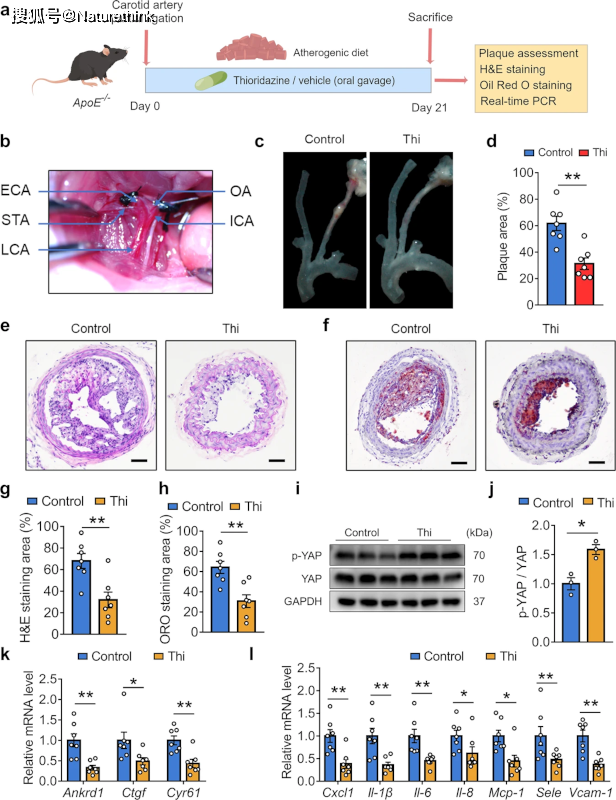 硫利达嗪通过抑制 rhoa/yap 介导的内皮炎症来防止扰动流诱导的动脉