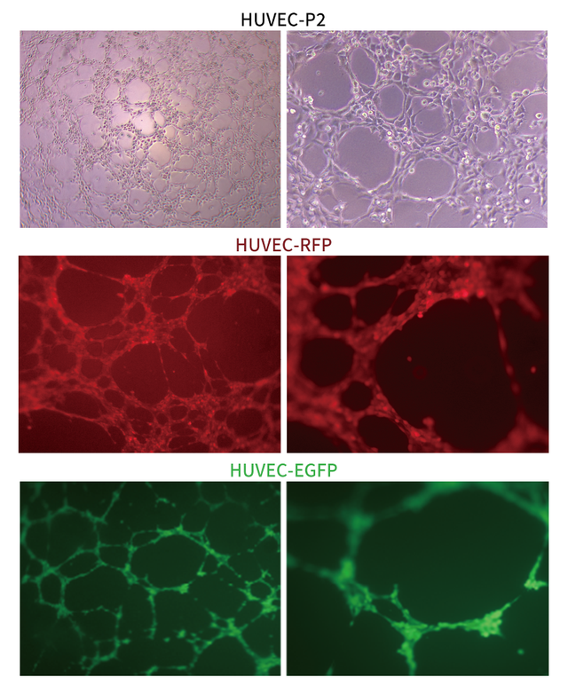 一步步教你掌握huvec血管生成实验:从理论到操作全覆盖!