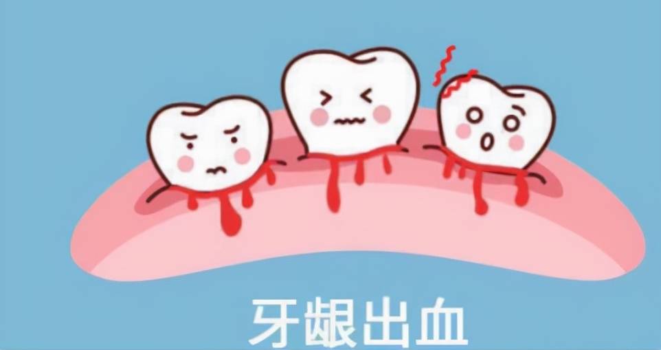全新总结十大电动牙刷排行:10款实力派产品分享!