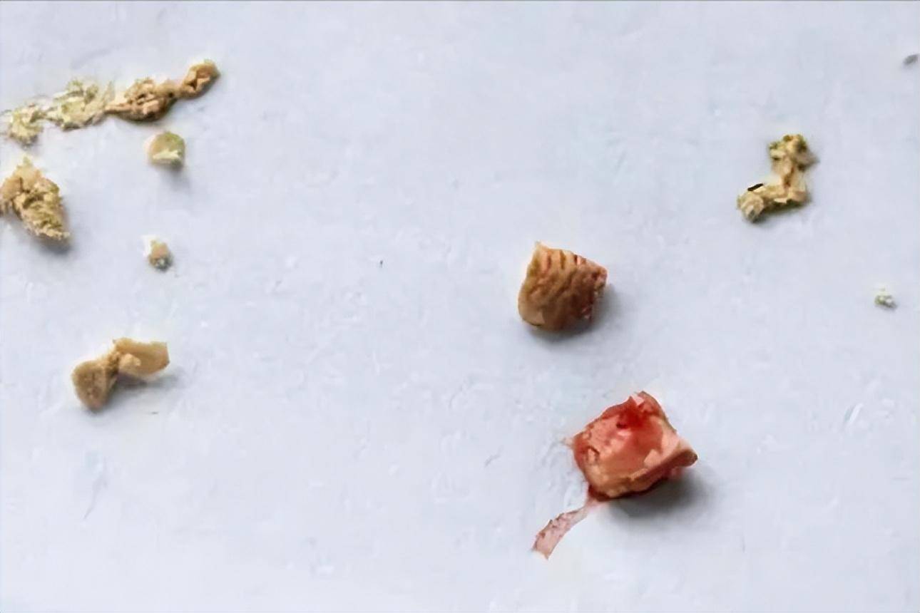 牙膏_食物残渣_牙齿