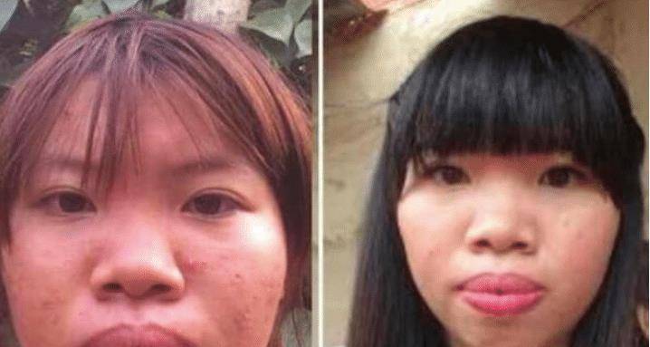 豪门,砸10万整容嫁给富二代,生完孩子后现原形被甩_郭金凤_长相_因为