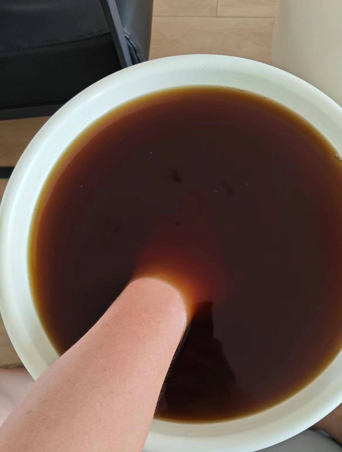 要想治愈腱鞘炎,用对方法才是关键!_活动_手部_屈伸