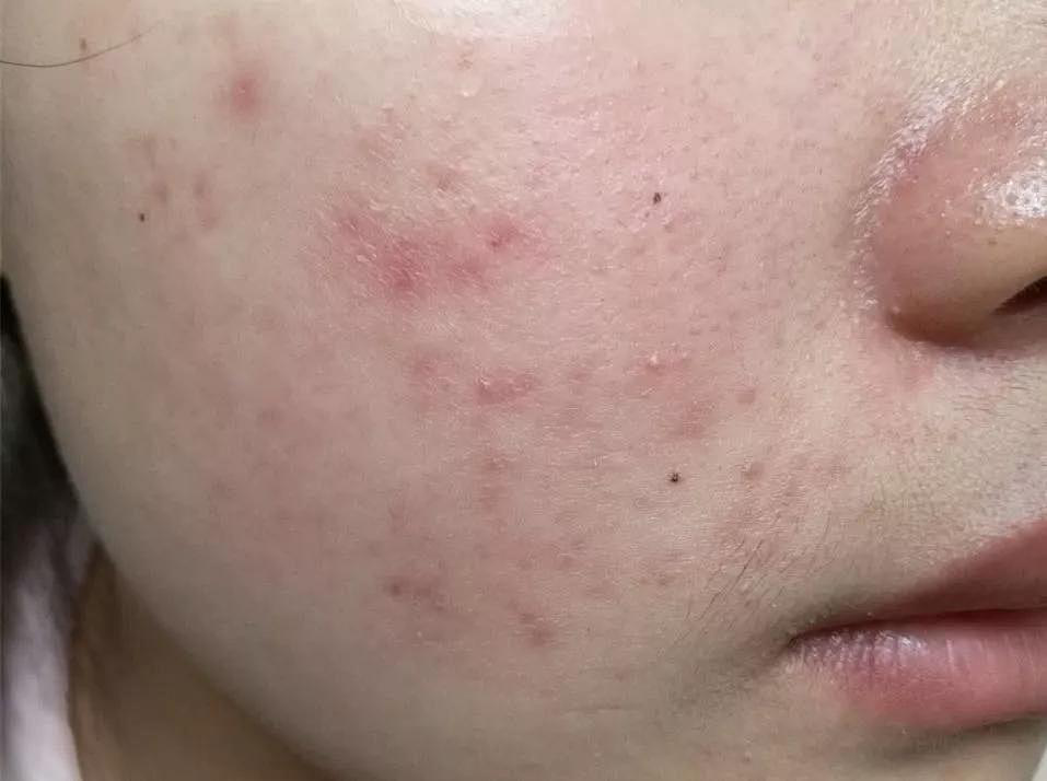 皮肤_补水_肌肤