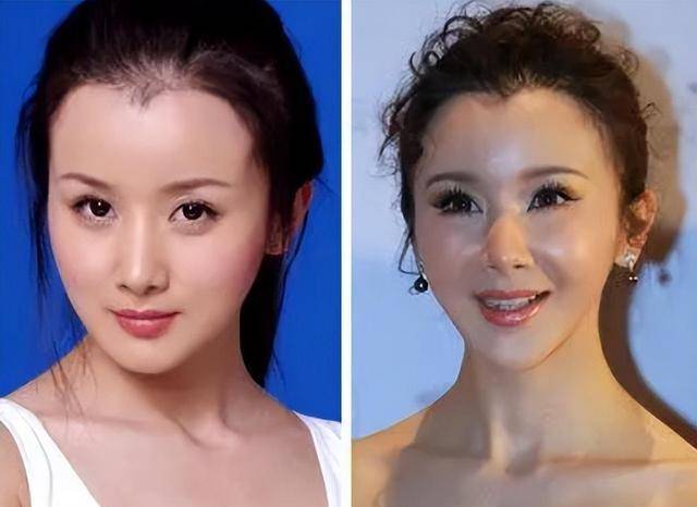 国家广电总局终于对"整容脸"出手了,宋丹丹说的话应验了_姜妍_金晨