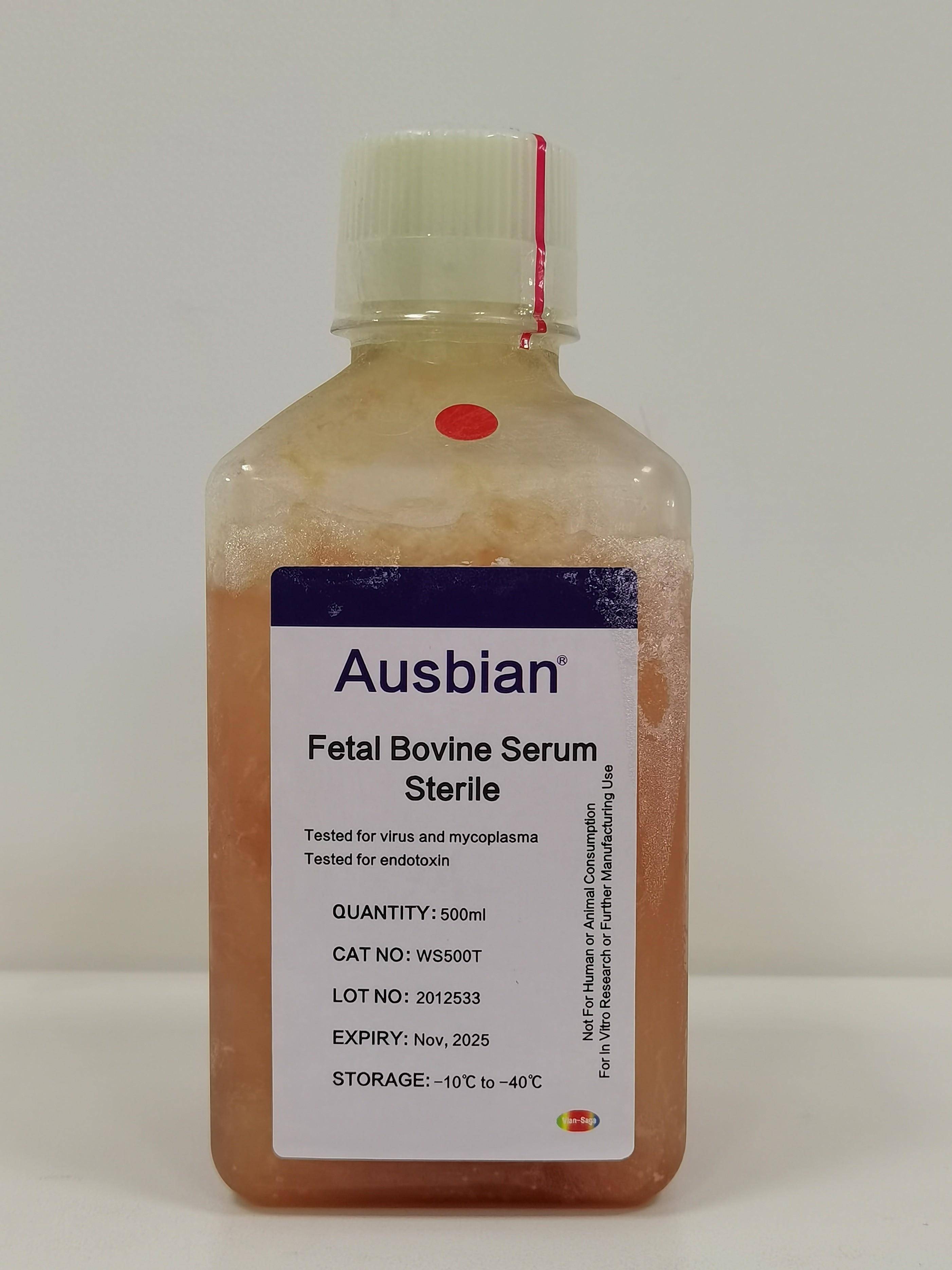 研究揭示早期胚胎发育过程中脂质代谢重塑,ausbian胎