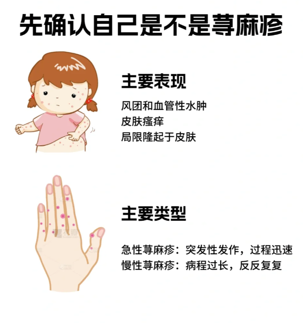 荨麻疹和湿疹的区别是什么?_皮肤_免疫_身体