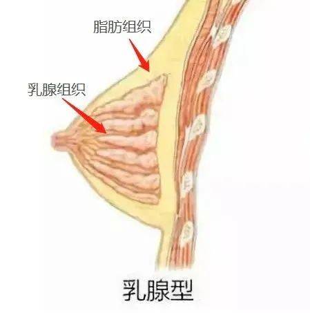 2,乳腺型胸部减肥主要减掉的是脂肪,这就会对于胸部的大小有一定的